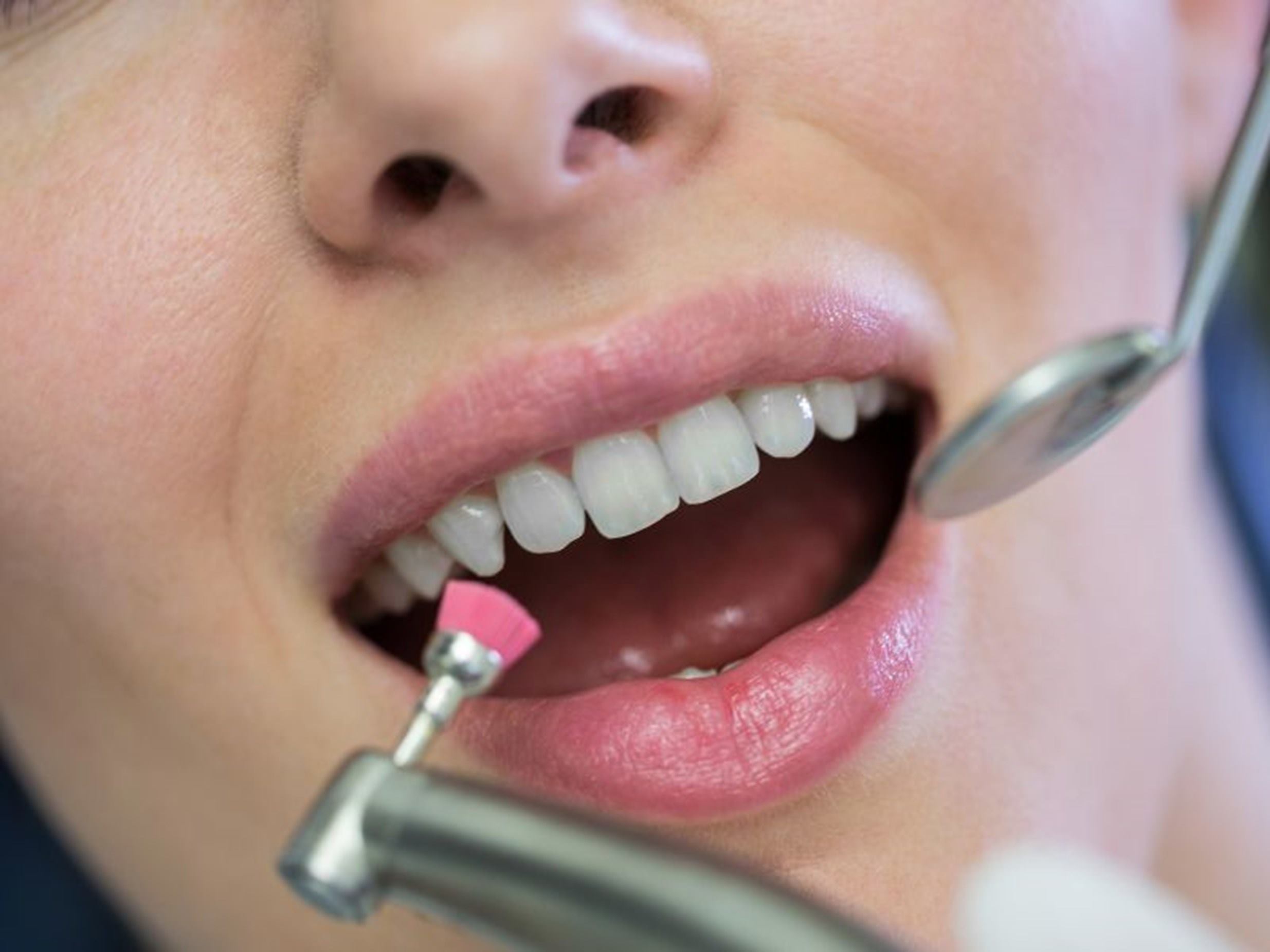 revision dental