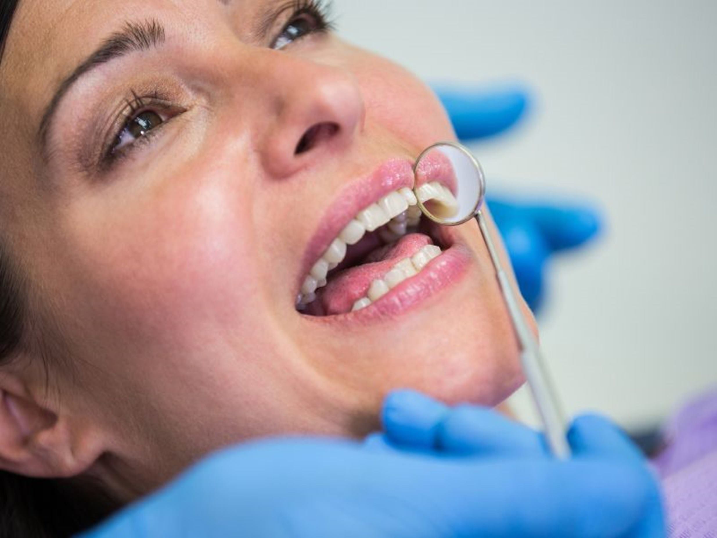 clinica carillas dentales