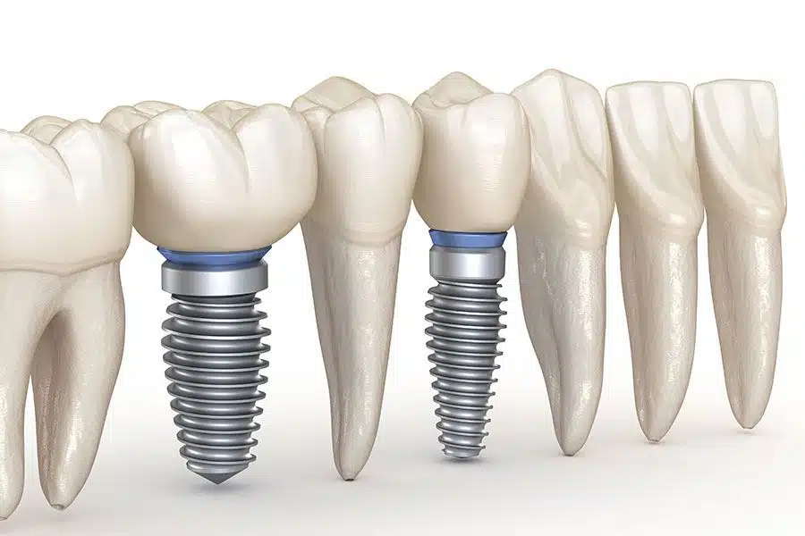 revision dental