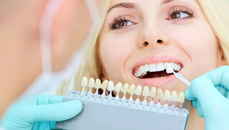 Carillas de porcelana a medida en la Clínica Dental Arosa de Peñagrande