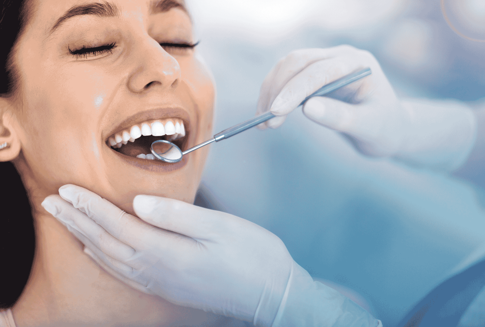 Sonrisa natural tras un tratamiento con carillas dentales en Peñagrande