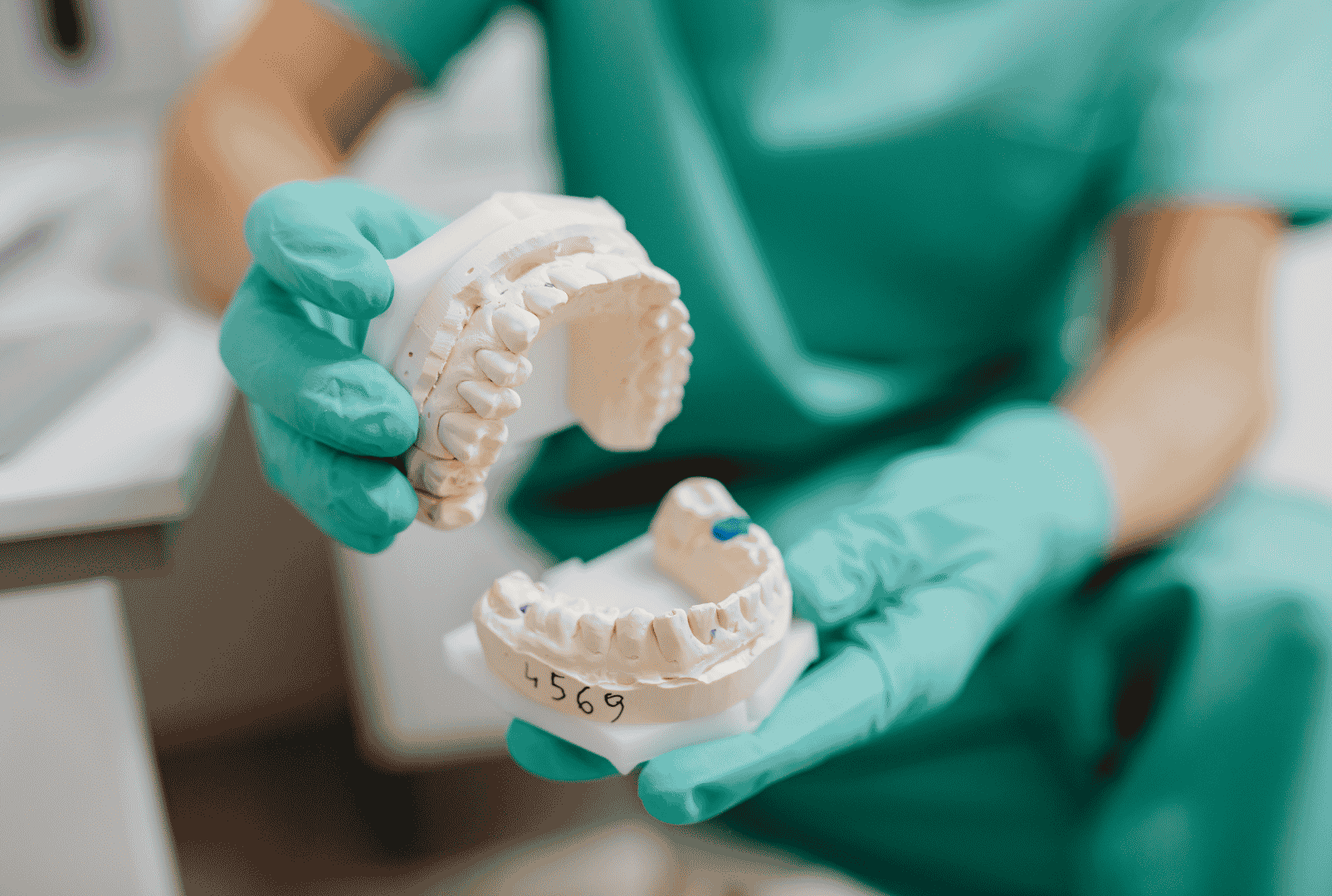 Moldes para la fabricación de una prótesis dental en la Clínica Dental Arosa de Peñagrande