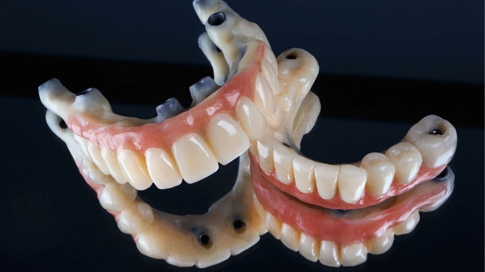 Prótesis fijas de arcada completa con los orificios de los tornillos que las fijan a los implantes