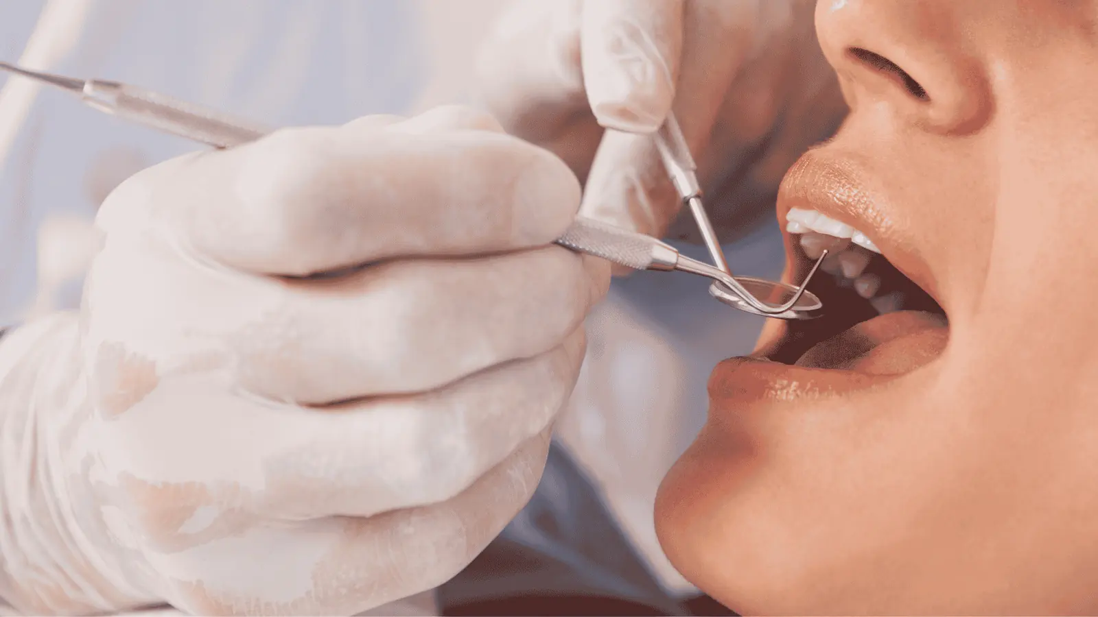 Revisión de encías para un tratamiento de periodoncia en Peñagrande